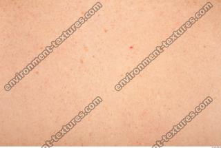 photo texture of white skin 0014